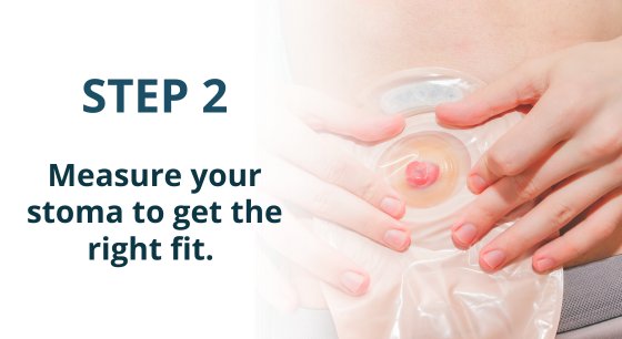 step 2 - measure your stoma size to get the right fit