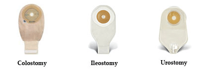 Ostomy Care Supply
