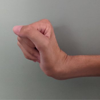 tenodesis wrist extension