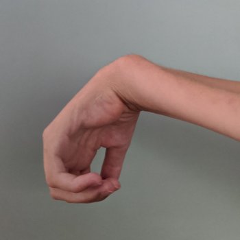 tenodesis wrist flexion or release