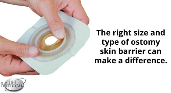 https://www.180medical.com/wp-content/uploads/2020/12/the-right-size-and-type-of-skin-barrier-can-make-a-difference-in-ostomy-leakage-1.jpg